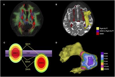 Spatial Gradient of Microstructural Changes in Normal-Appearing White Matter in Tracts Affected by White Matter Hyperintensities in Older Age